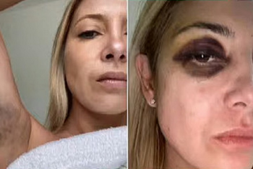 LA DENUNCIA DE FABIOLA YAÑEZ CONTRA ALBERTO FERNÁNDEZ: “VENÍS GOLPEÁNDOME HACE TRES DÍAS SEGUIDOS”